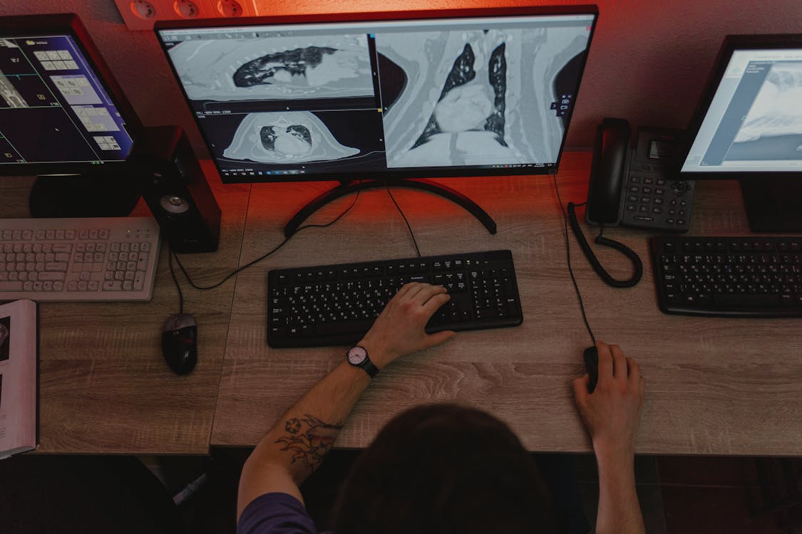 Visualizadores